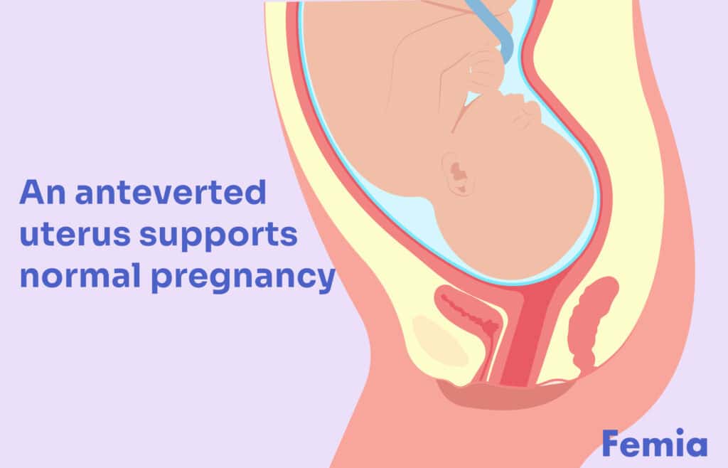 Graphic stating that an anteverted uterus supports a normal pregnancy.