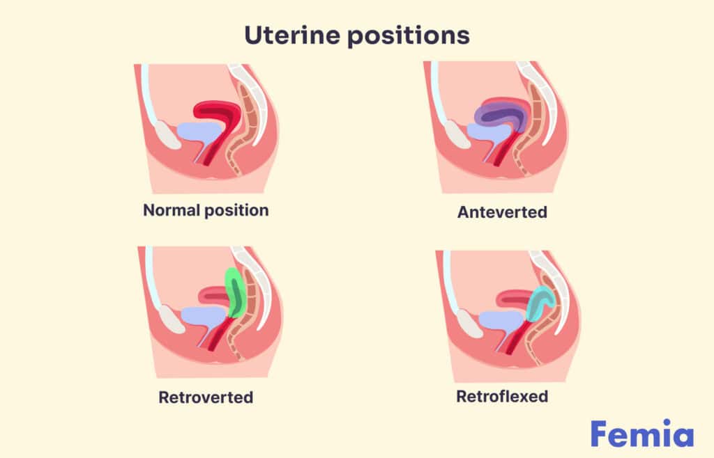 Illustration comparing anteverted, retroverted, and mid-position uterine orientations, discussing if an anteverted uterus is good or bad.