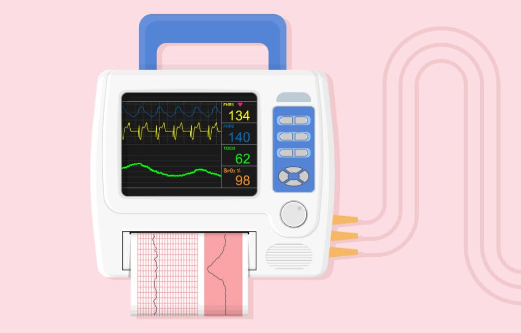 Illustration of a heart rate monitor displaying fetal heart rates, uterine contractions, and maternal oxygen saturation.