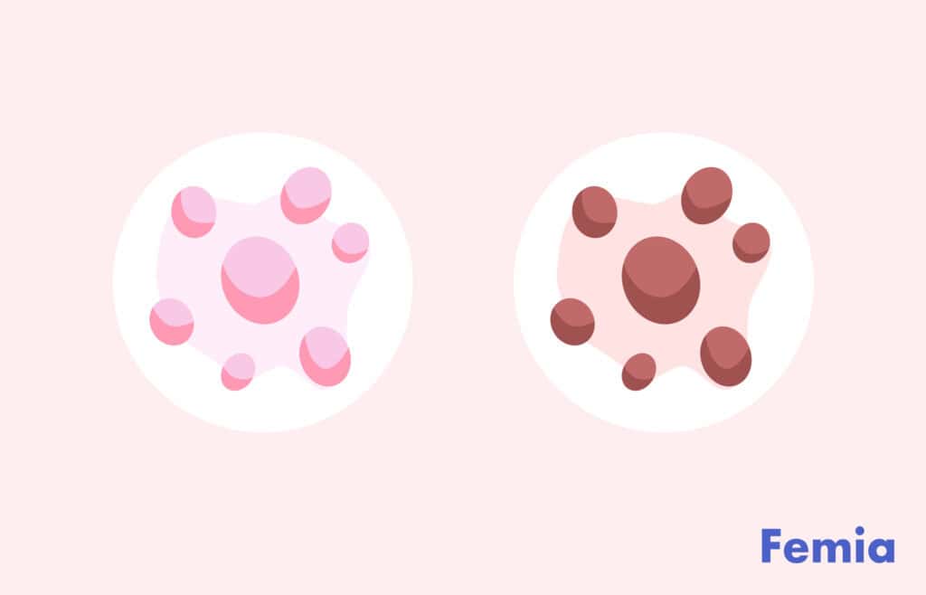 Illustration showing two blood stains, one pink and one brown, representing different types of vaginal discharge.