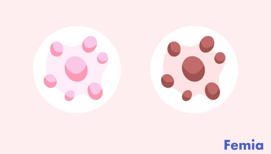 Illustration showing brown and pink discharge spots side by side.