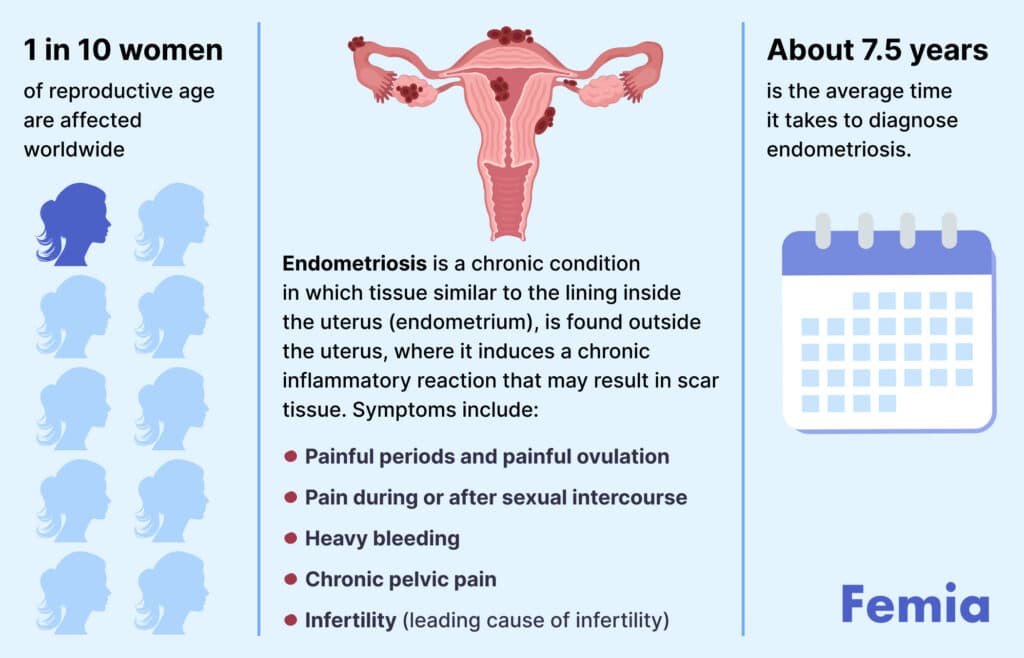 Infographic explaining endometriosis, including its prevalence, symptoms, and average diagnosis time.