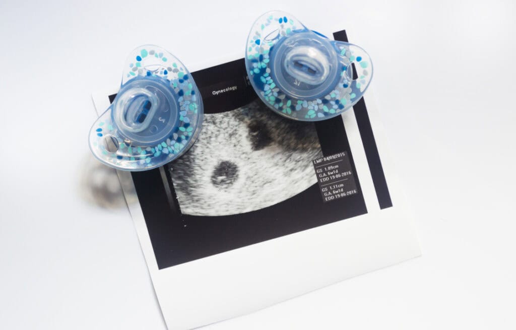 Two pacifiers placed on an ultrasound image showing twin embryos.