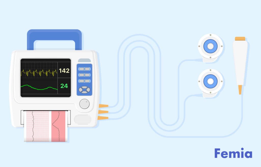 Fetal heart rate monitor, used to check for late decelerations.