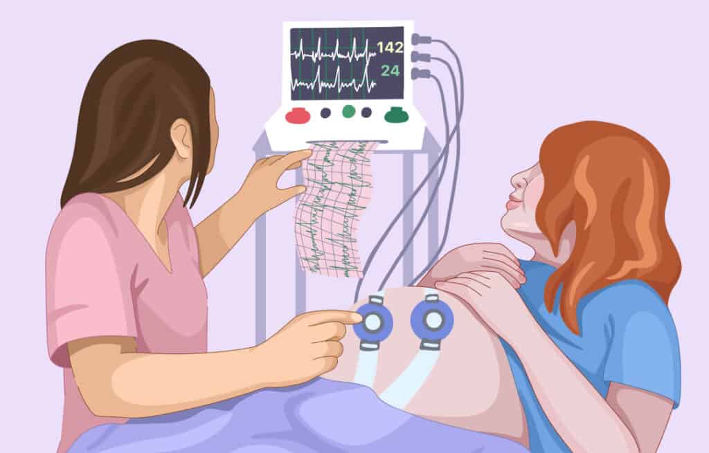 A nurse monitoring a pregnant woman's fetal heart rate, checking for early decelerations. Viewers of this file can see comments and suggestions.