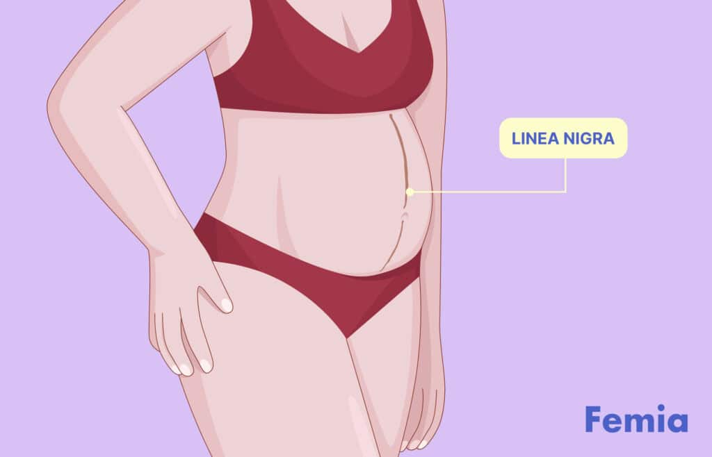 Illustration of a pregnant woman with a linea nigra, a dark vertical line running down her belly. Viewers of this file can see comments and suggestions.