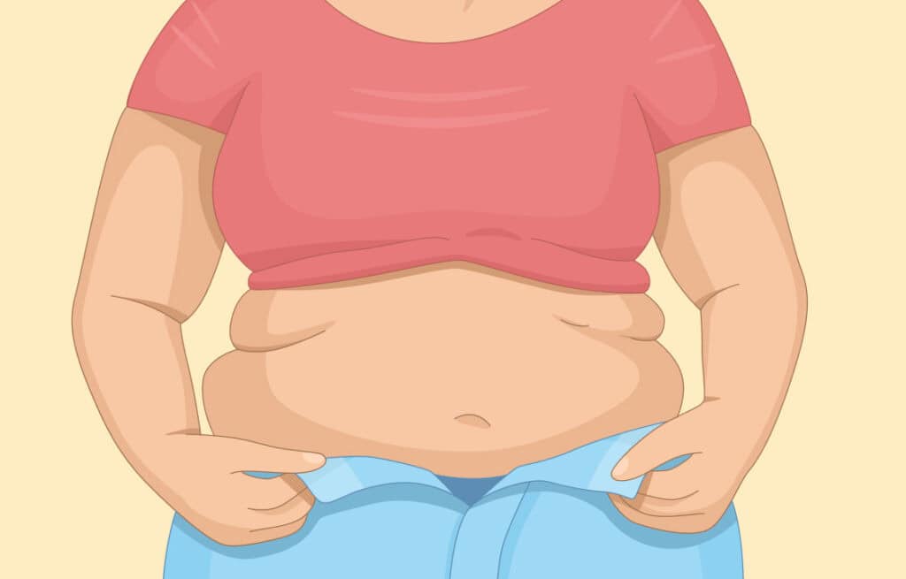 A woman showing a common PCOS belly shape.