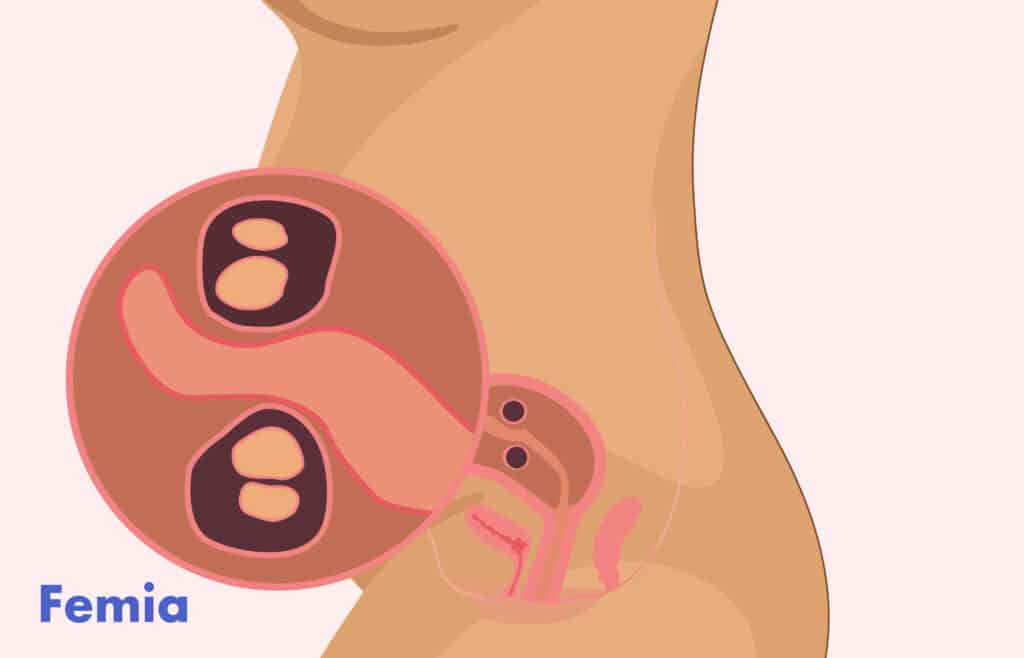 Illustration of a twin pregnancy belly, twins in the womb at 8 weeks gestation.
