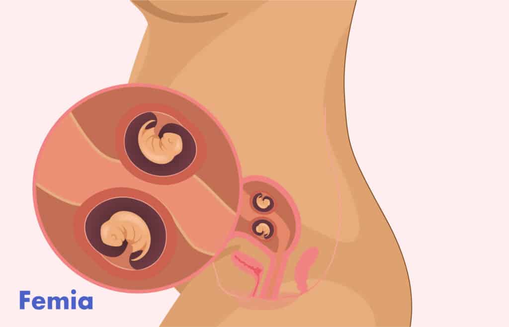 Illustration of a twin pregnancy belly, twins in the womb at 12 weeks gestation.