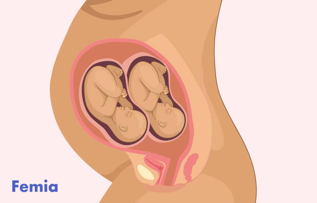 Illustration of a twin pregnancy belly, twins in the womb at 32 weeks gestation.