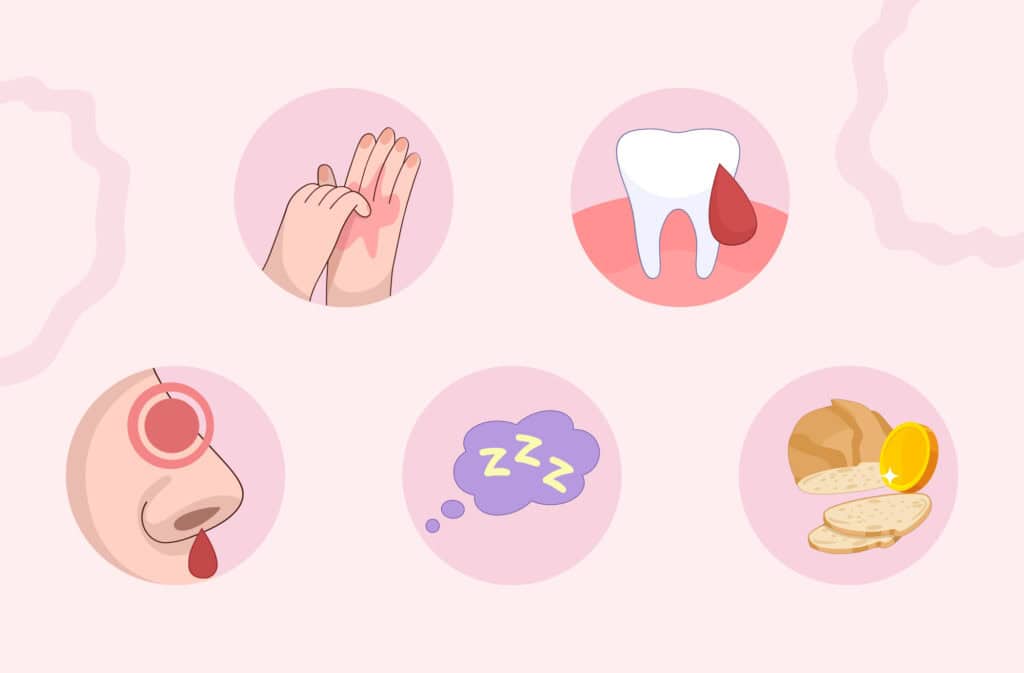 Icons representing weird pregnancy symptoms, including itchy skin, bleeding gums, nosebleeds, fatigue, and cravings.