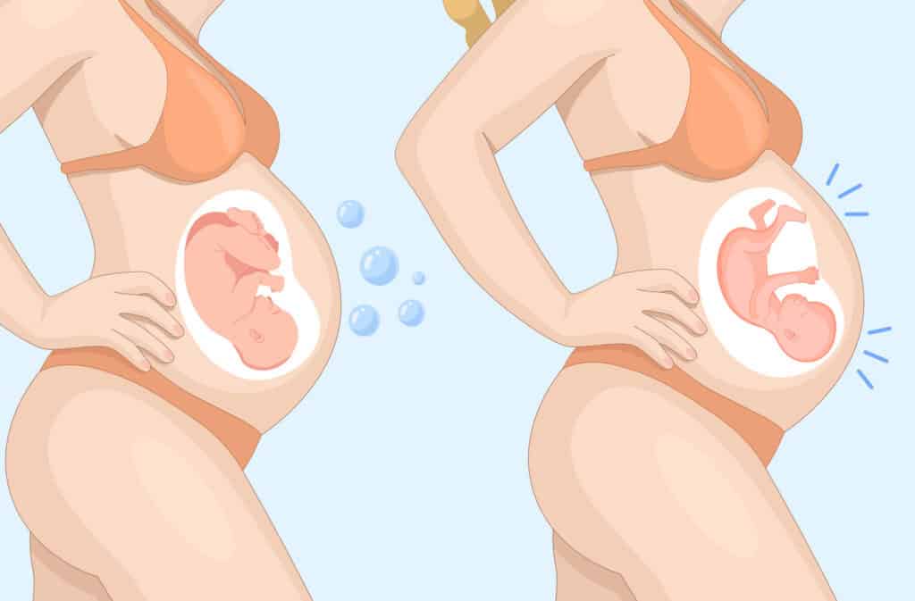 illustration of a pregnant women showing the difference between gas bubbles and baby moving.