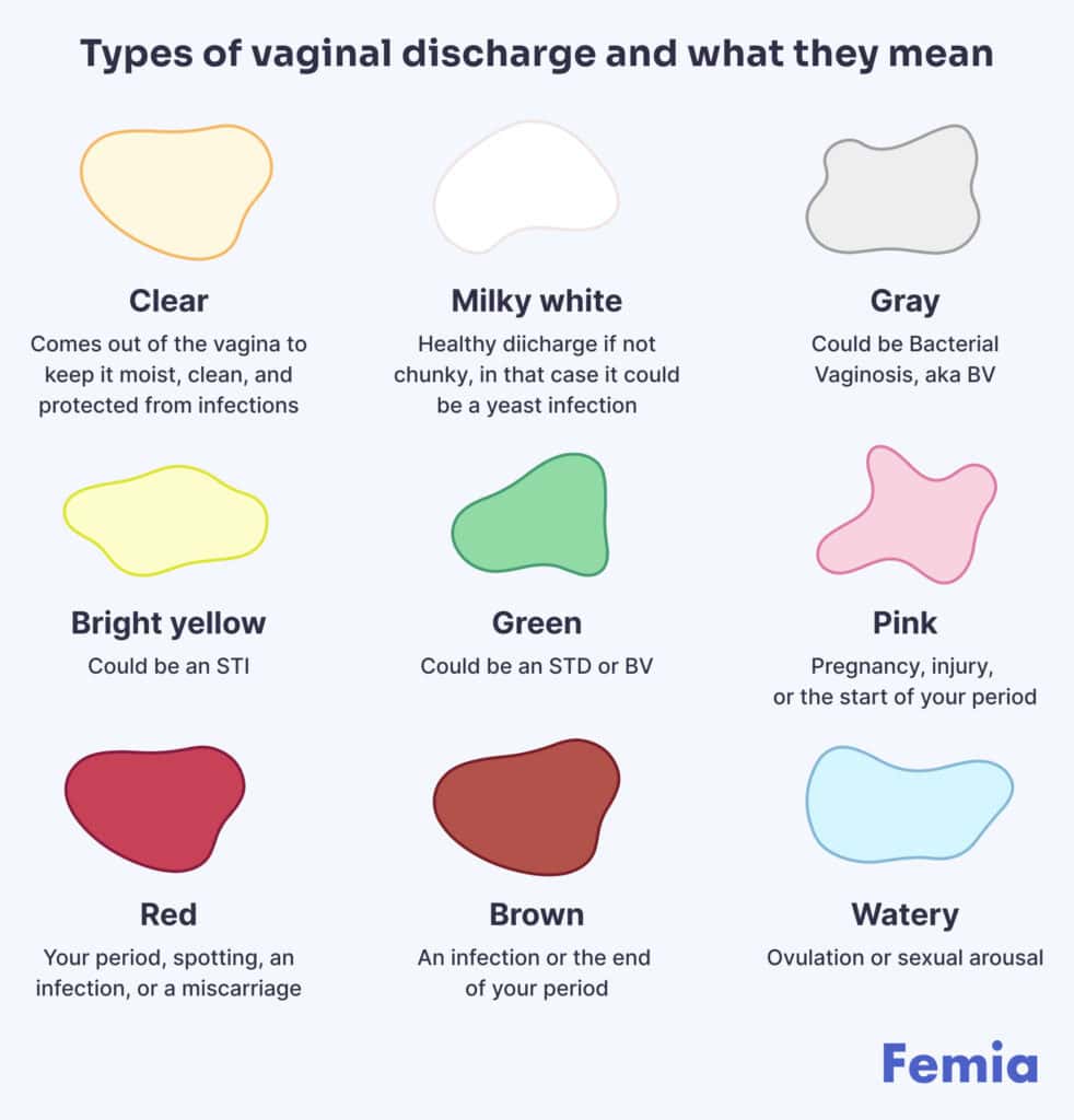 An illustration showing types of vaginal discharge and what they mean.