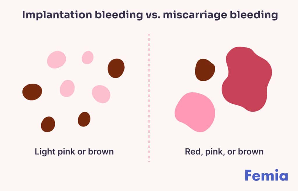 An illustration showing the difference between implantation bleeding vs. miscarriage.