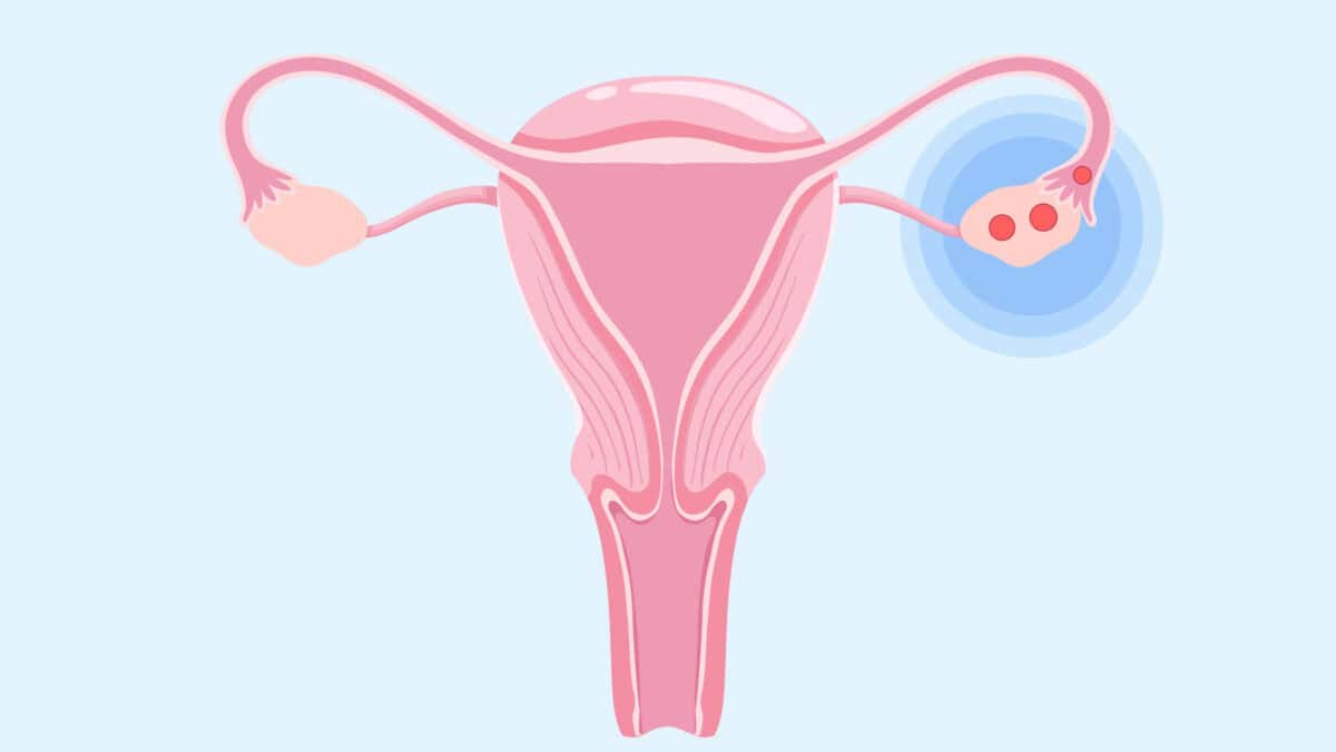 Ovulation Spotting Twins Pictures Of Heavy Implantation Bleeding
