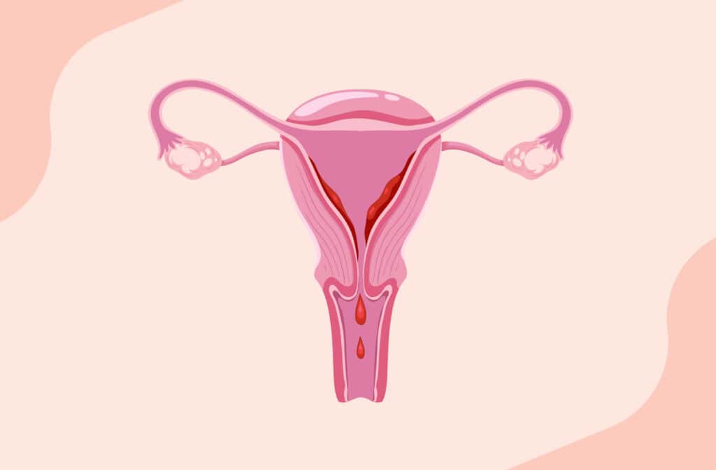 An image of a women reproductive system representing implantation bleeding vs. miscarriage.