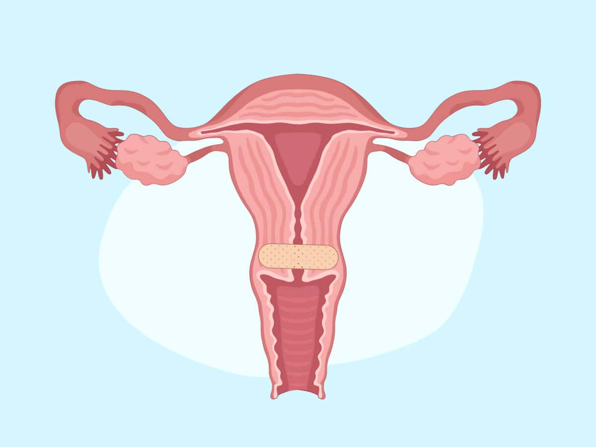 cervix Bruised cervix symptoms: Causes, signs, and when to seek - Femia