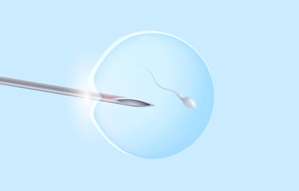 An image of in vitro fertilization representing How long does IVF take