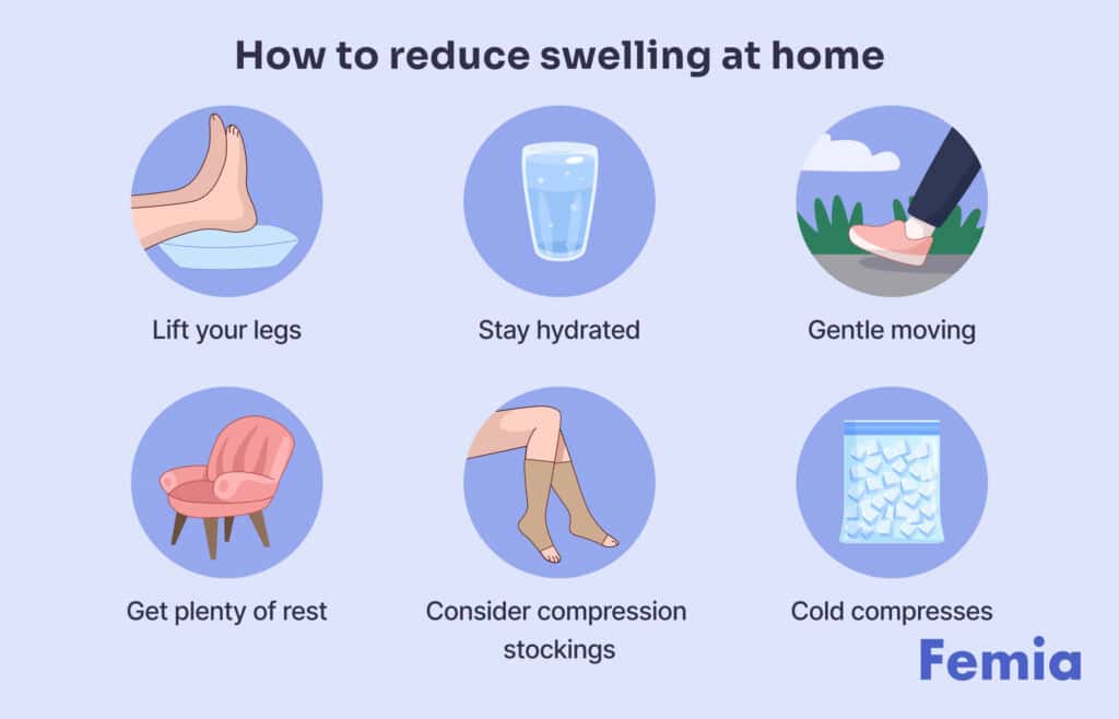 An infographic showing how to reduce postpartum swelling at home.