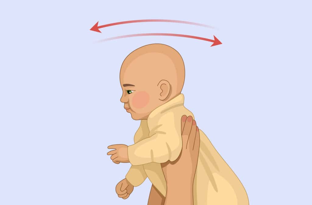 An illustration of a shaken baby representing shaken baby syndrome.