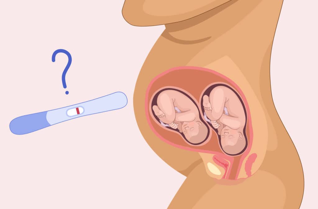 An illustration of twins in the belly and a negative pregnancy test, representing the question Can twins cause false negative pregnancy test?