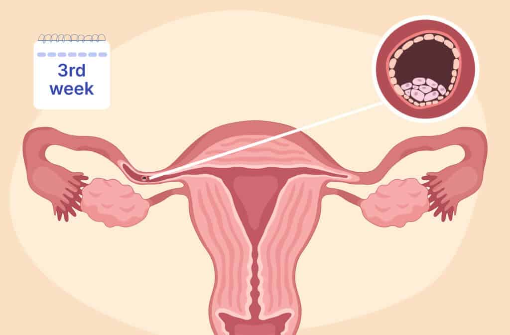 An illustration of a uterus and a zygote representing 3 weeks pregnant.