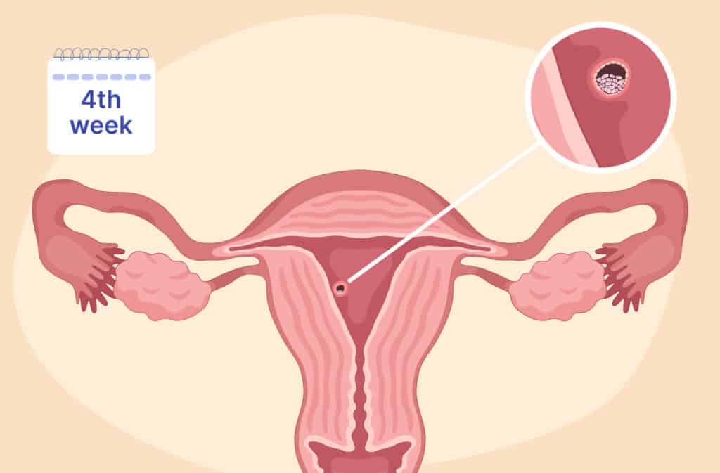 An illustration of a uterus and a blastocyst representing 4 weeks pregnant.