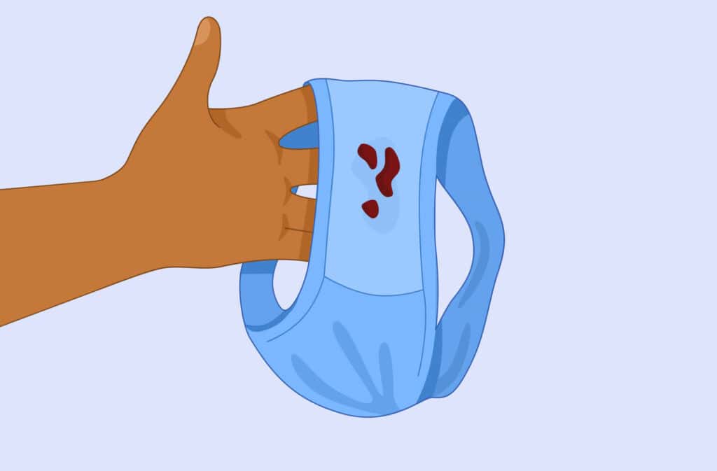 An illustration of a hand holding underwear covered in brown discharge.