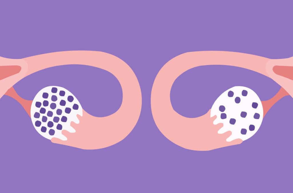 An illustration of ovaries representing how many eggs does a woman have.