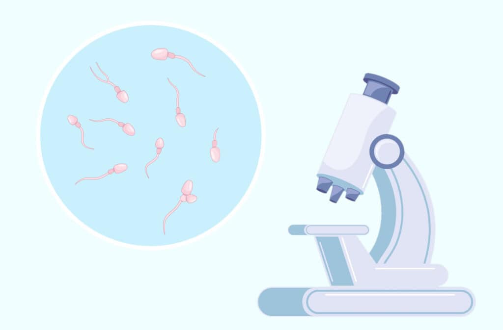 An illustration of a spermogram and a microscope representing male infertility.