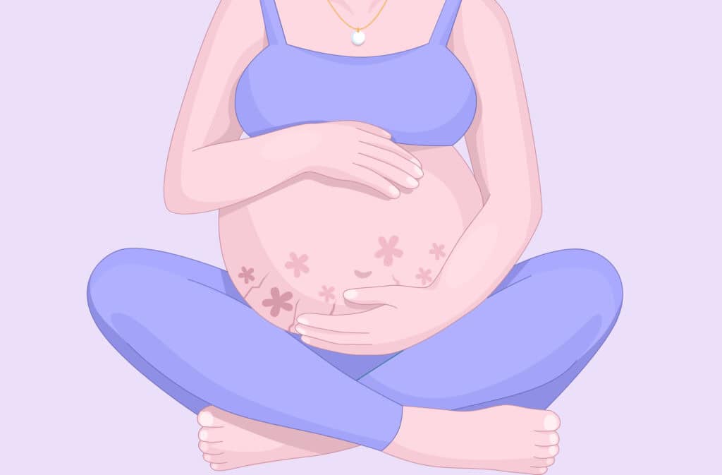 An illustration of a pregnant woman sitting in a lotus pose and showing a puppp rush on her belly.