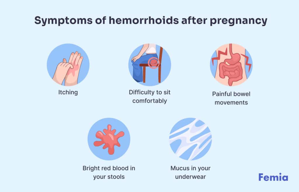 A chart showing symptoms of hemorrhoids after pregnancy.