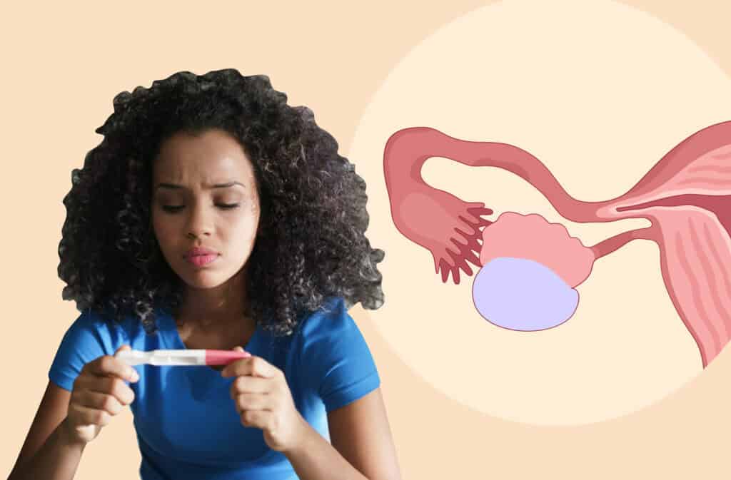 An image showing an illustration of an ovary with a cyst and a woman holding a pregnancy test wondering 'Can ovarian cyst cause infertility?'