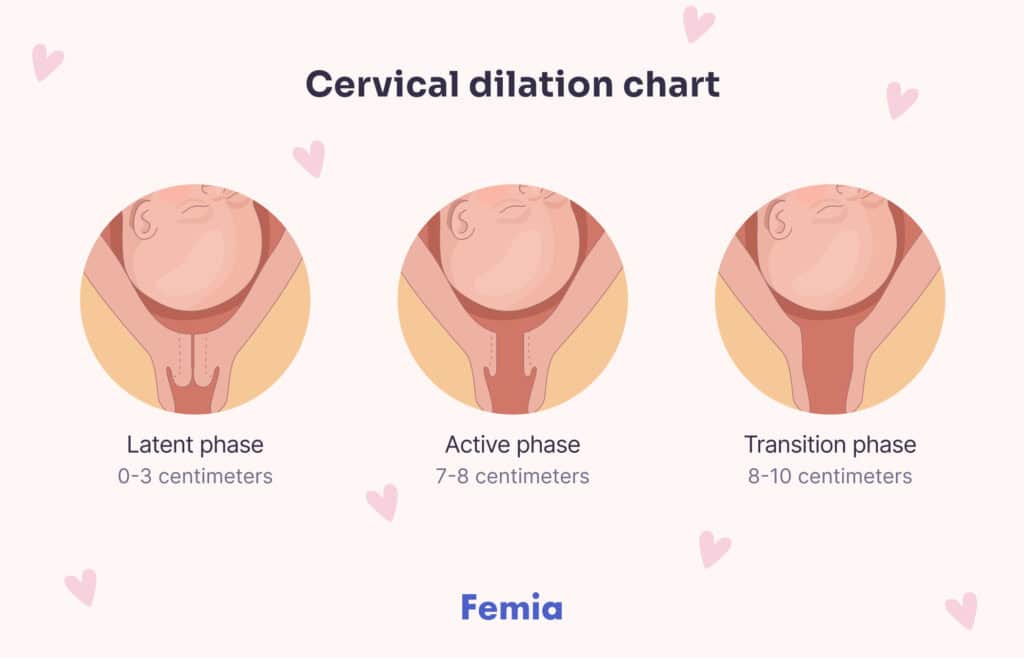 An illustration showing a cervical dilation chart.