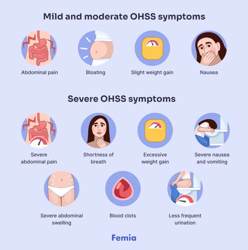 An infographic showing mild, moderate and severe OHSS symptoms.