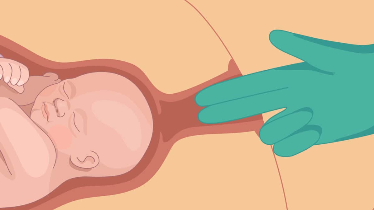 Signs And Stages Of A Real Dilated Cervix In Pregnancy - Femia, image size:1200x675