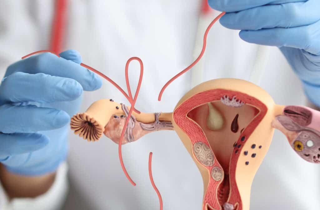 A photo of the doctor's hands untying a ban on the plastic uterus model representing the question 'How soon after tubal reversal can I try to conceive?'.