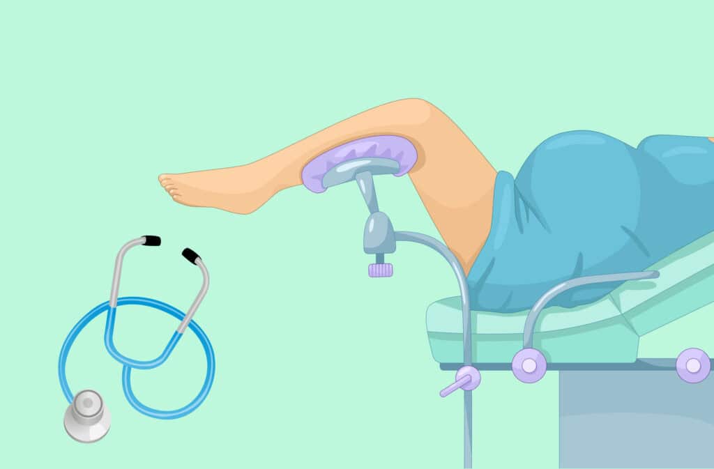 An illustration of a woman having cervical checks during pregnancy.