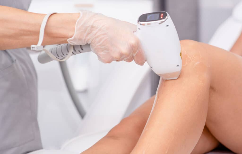 A photo of a specialist's hand over a woman lags during hair removal. representing the question 'can you get laser hair removal while pregnant?'