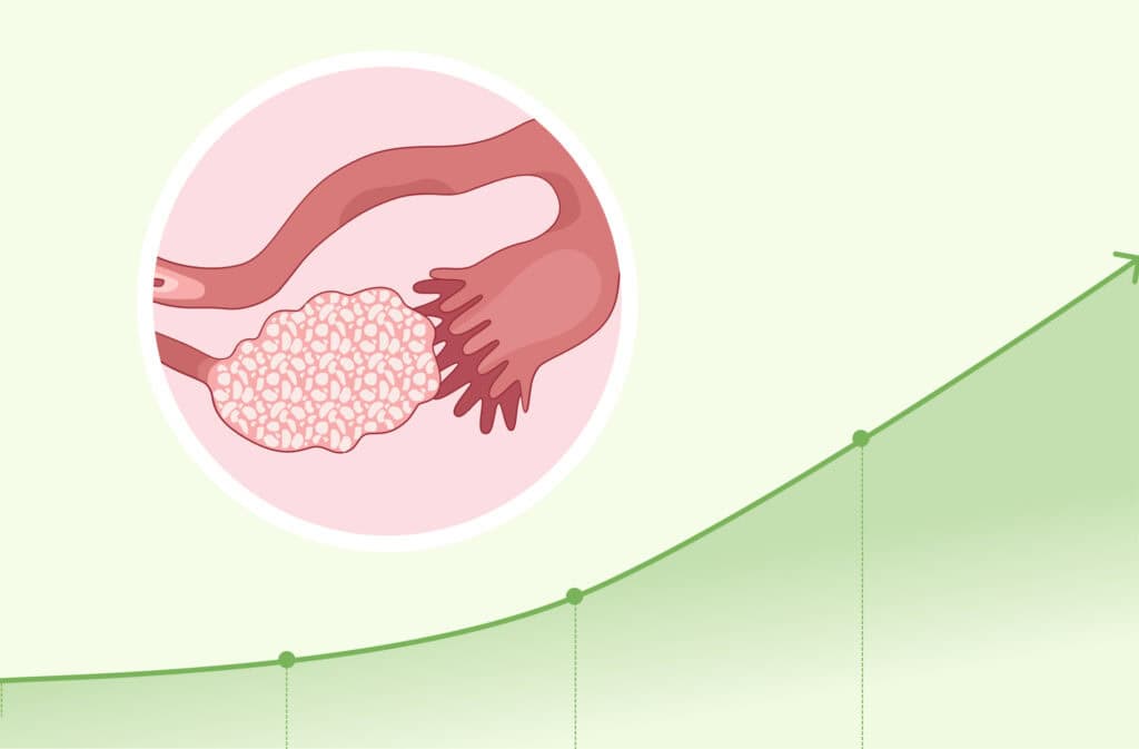 An illustration of an ovary and a chart on a background, representing 'How to increase AMH levels'