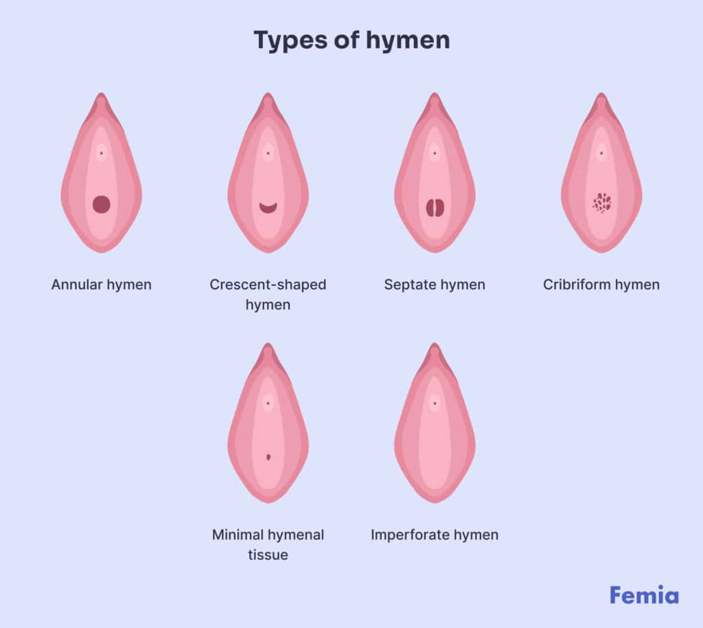 An illustration showing types of hyman.