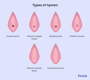 Hymen Breakage Signs: Learning The Anatomy And Debunking Myths - Femia